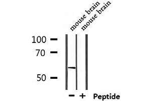 Western blot analysis of extracts from mouse brain, using USP17L Antibody. (USP17L9P antibody)