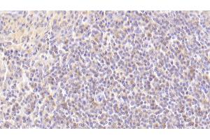 Detection of MAP2K7 in Human Spleen Tissue using Polyclonal Antibody to Mitogen Activated Protein Kinase Kinase 7 (MAP2K7) (MAP2K7 antibody  (AA 113-388))