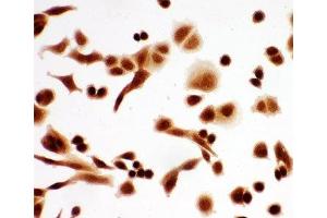 ICC testing of A549 cells (TCP1 alpha/CCTA antibody  (AA 82-98))
