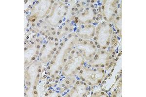 Immunohistochemistry of paraffin-embedded rat kidney using POP4 antibody (ABIN6128482, ABIN6145964, ABIN6145966 and ABIN6220640) at dilution of 1:100 (40x lens).