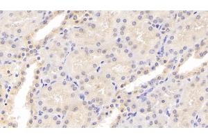 Immunohistochemistry (IHC) image for anti-Tumor Necrosis Factor Receptor Superfamily, Member 11b (TNFRSF11B) (AA 1-196) antibody (ABIN7425698)