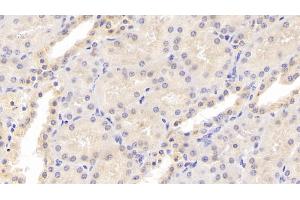 Detection of OPG in Human Kidney Tissue using Monoclonal Antibody to Osteoprotegerin (OPG)
