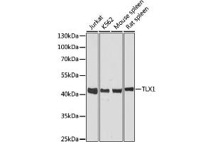 Western blot analysis of extracts of various cell lines, using TLX1 antibody (ABIN6131789, ABIN6149229, ABIN6149230 and ABIN6216643) at 1:3000 dilution.
