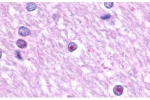 Image no. 1 for anti-Lysophosphatidic Acid Receptor 1 (LPAR1) (N-Term) antibody (ABIN1048529) (LPAR1 antibody  (N-Term))