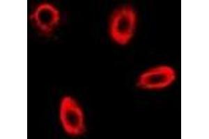 Immunofluorescent analysis of FBP1 staining in MCF7 cells. (FBP1 antibody)