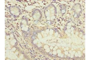 Immunohistochemistry of paraffin-embedded human small intestine tissue using ABIN7165370 at dilution of 1:100 (FAM118B antibody  (AA 83-351))