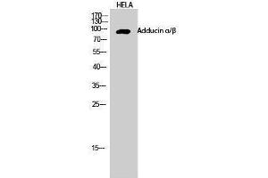 Western Blotting (WB) image for anti-Adducin alpha/beta (Lys5) antibody (ABIN3173689)