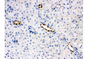Anti-Glucose Transporter 8 antibody, IHC(P) IHC(P): Rat Kidney Tissue (SLC2A8 antibody  (C-Term))