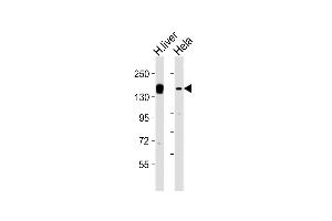 All lanes : Anti-KDM6A Antibody (Center) at 1:2000 dilution Lane 1: human liver lysates Lane 2: Hela whole cell lysates Lysates/proteins at 20 μg per lane. (KDM6A antibody  (AA 797-832))