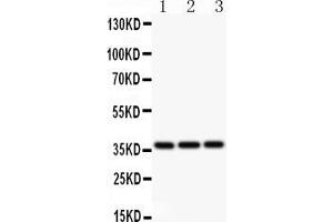 Western Blotting (WB) image for anti-BMI1 Polycomb Ring Finger Oncogene (BMI1) (AA 135-165), (Middle Region) antibody (ABIN3043799)