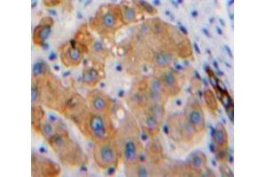 IHC-P analysis of Liver tissue, with DAB staining. (Hexosaminidase A antibody  (AA 319-528))