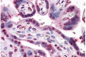 Human Placenta: Formalin-Fixed, Paraffin-Embedded (FFPE) (PRKG1 antibody  (AA 73-171))
