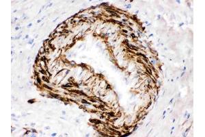 IHC analysis of SMYD3 using anti-SMYD3 antibody (ABIN3044548).