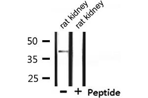 Western blot analysis of extracts from rat kidney, using CCRL1 Antibody.