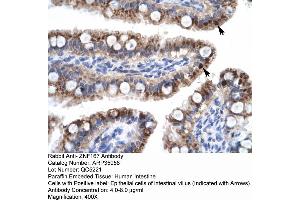 Human Intestine (Zinc Finger with KRAB and SCAN Domains 7 (ZKSCAN7) (N-Term) antibody)