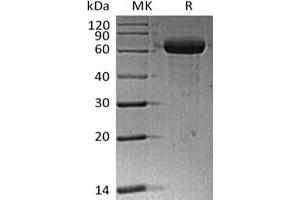 Western Blotting (WB) image for Sialic Acid Binding Ig-Like Lectin 15 (SIGLEC15) (Active) protein (Fc Tag) (ABIN7319768) (SIGLEC15 Protein (Fc Tag))