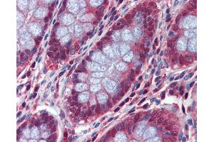 Anti-DACT2 antibody IHC of human colon. (DACT2 antibody  (N-Term))