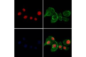 ABIN7094087 and ABIN7098131 staining Hela cells by IF/ICC.