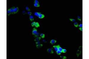 Immunofluorescence staining of PC3 cells with ABIN7167972 at 1:133, counter-stained with DAPI. (ARHGEF18 antibody  (AA 159-551))