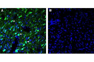 Expression of 5HT6 in in rat dorsal raphe nucleus (DRN). (Serotonin Receptor 6 antibody  (Extracellular))