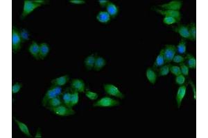 Immunofluorescent analysis of HepG2 cells using ABIN7158476 at dilution of 1:100 and Alexa Fluor 488-congugated AffiniPure Goat Anti-Rabbit IgG(H+L) (CES1 antibody  (AA 291-566))