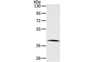 Western Blotting (WB) image for anti-Cyclin-Dependent Kinase 10 (CDK10) antibody (ABIN2421367) (CDK10 antibody)
