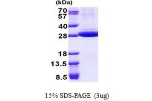 Stomatin Protein (STOM) (AA 55-288) (His tag)