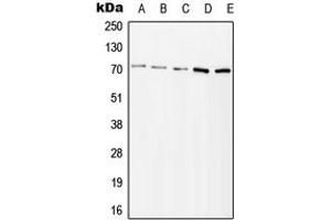 Western blot analysis of ZAP70 (pY315) expression in Jurkat H2O2-treated (A), HeLa H2O2-treated (B), Ramos lambda phosphatase-treated (C), mouse kidney (D), rat kidney (E) whole cell lysates. (ZAP70 antibody  (pTyr315))
