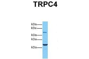 Host:  Rabbit  Target Name:  TRPC4  Sample Tissue:  Human 293T  Antibody Dilution:  1. (TRPC4 antibody  (Middle Region))