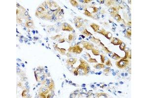Immunohistochemistry of paraffin-embedded Human stomach using CCL21 Polyclonal Antibody at dilution of 1:100 (40x lens). (CCL21 antibody)