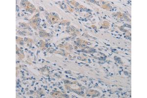 Immunohistochemistry (IHC) image for anti-Platelet-Activating Factor Receptor (PTAFR) antibody (ABIN2432185)