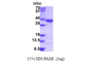 SDS-PAGE (SDS) image for Coatomer Protein Complex, Subunit epsilon (COPE) (AA 1-308) protein (His tag) (ABIN5779054)