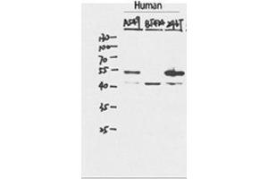 Western Blotting (WB) image for anti-Tumor Protein P53 (TP53) (C-Term) antibody (ABIN3186273)