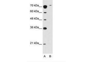 Image no. 2 for anti-Solute Carrier Family 7 (Cationic Amino Acid Transporter, Y+ System), Member 14 (SLC7A14) (AA 131-180) antibody (ABIN396880) (SLC7A14 antibody  (AA 131-180))