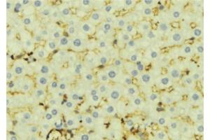 ABIN6276924 at 1/100 staining Mouse liver tissue by IHC-P. (CES1 antibody  (C-Term))