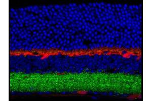 Immunohistochemistry of Anti-GABA(A) Receptor beta 3 (Rabbit) Antibody Immunohistochemistry of Anti-GABA(A) Receptor beta 3 (Rabbit) Antibody. (GABRB3 antibody  (Cytoplasmic Loop))