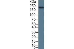 Rabbit Detection antibody from the kit in WB with Positive Control: Sample Rat heart lysate. (MYH6 ELISA Kit)