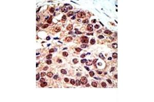 Image no. 3 for anti-Protein Arginine Methyltransferase 3 (PRMT3) (C-Term) antibody (ABIN356525) (PRMT3 antibody  (C-Term))