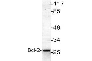 Image no. 1 for anti-B-Cell CLL/lymphoma 2 (BCL2) antibody (ABIN265326) (Bcl-2 antibody)
