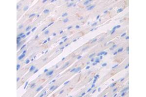 IHC-P analysis of heart tissue, with DAB staining. (Triadin antibody  (AA 344-693))
