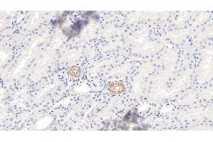 Detection of MYH11 in Human Kidney Tissue using Polyclonal Antibody to Myosin Heavy Chain 11, Smooth Muscle (MYH11) (MYH11 antibody  (AA 162-315))