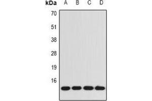 Western blot analysis of BDNF expression in A549 (A), SW480 (B), mouse kidney (C), rat brain (D) whole cell lysates. (BDNF antibody)