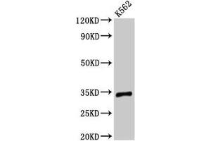 Western Blot Positive WB detected in: K562 whole cell lysate All lanes: TMEM177 antibody at 3 μg/mL Secondary Goat polyclonal to rabbit IgG at 1/50000 dilution Predicted band size: 34 kDa Observed band size: 34 kDa (TMEM177 antibody  (AA 219-311))