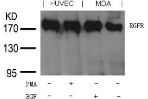 Image no. 1 for anti-Epidermal Growth Factor Receptor (EGFR) (Tyr1197) antibody (ABIN401657) (EGFR antibody  (Tyr1197))