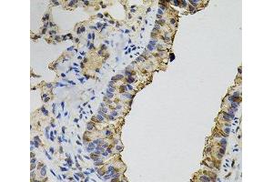 Immunohistochemistry of paraffin-embedded Mouse lung using DNM2 Polyclonal Antibody (DNM2 antibody)