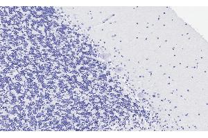 ABIN1049520 Negative Control showing staining of paraffin embedded Human Cerebellum, with no primary antibody. (HTR2A antibody  (AA 296-309))