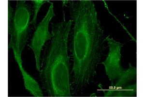 Immunofluorescence of monoclonal antibody to LRRK1 on HeLa cell. (LRRK1 antibody  (AA 560-659))