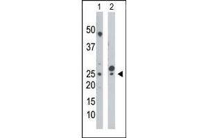 Western Blotting (WB) image for anti-Cytidine Monophosphate (UMP-CMP) Kinase 1, Cytosolic (CMPK1) (N-Term) antibody (ABIN360613) (Cytidine Monophosphate (UMP-CMP) Kinase 1, Cytosolic (CMPK1) (N-Term) antibody)