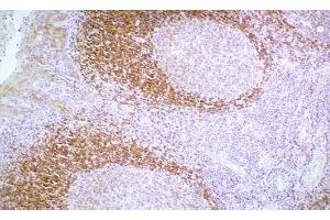 Image no. 1 for anti-Cadherin 1, Type 1, E-Cadherin (Epithelial) (CDH1) antibody (ABIN335398) (E-cadherin antibody)