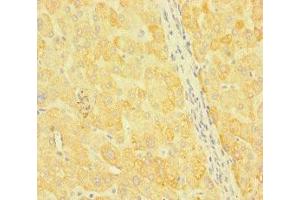 Immunohistochemistry of paraffin-embedded human liver tissue using ABIN7170352 at dilution of 1:100